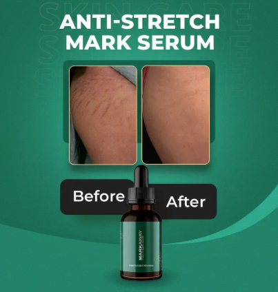 Markaway Stretch Mark Serum | Herbal Skin Repair